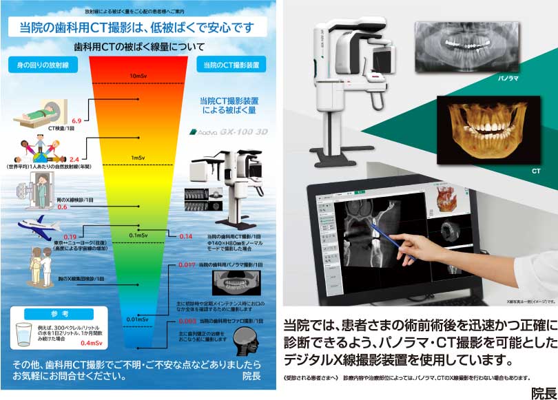 パノラマ・CT撮影のできる、低被ばくデジタルX線撮影装置を使用