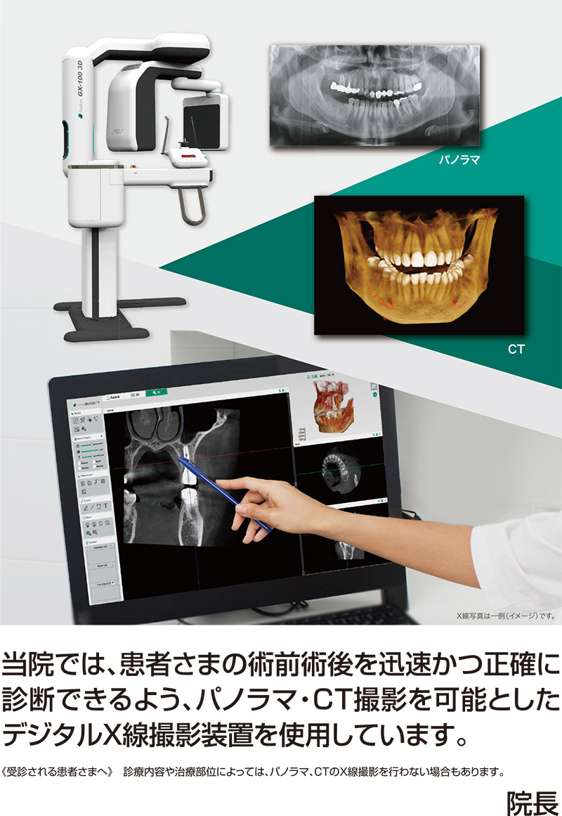 当院では、患者様の術前術後を迅速かつ正確に診断できるよう、パノラマ・CT撮影を可能としたデジタルX線撮影装置を使用しています。